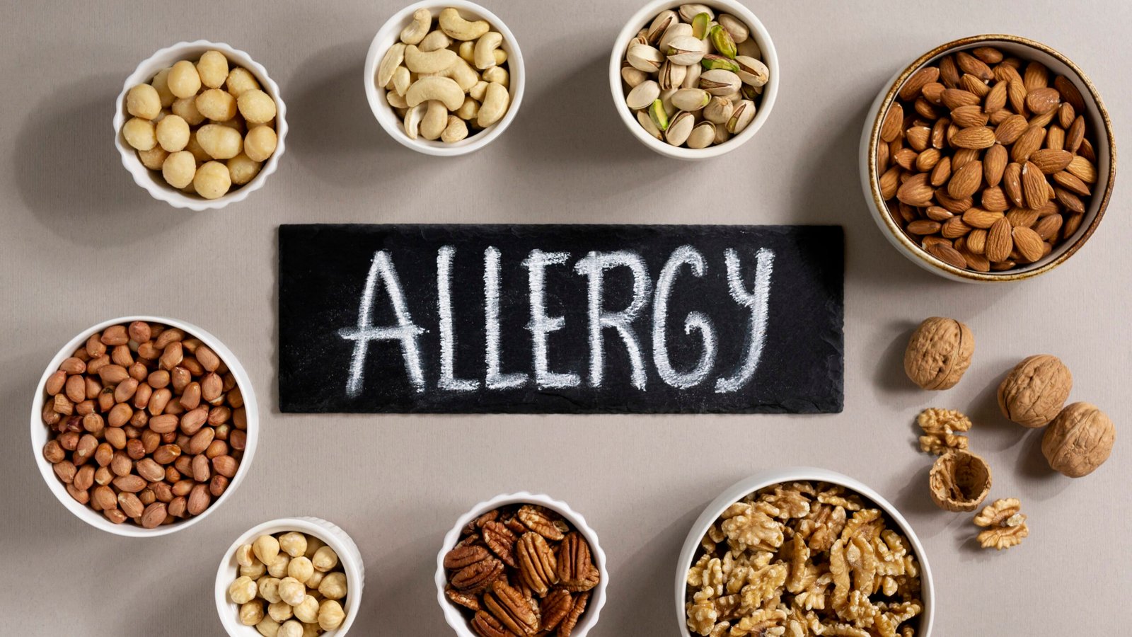 Unlocking Allergy Wisdom: Navigating Everyday Life with Allergen Awareness